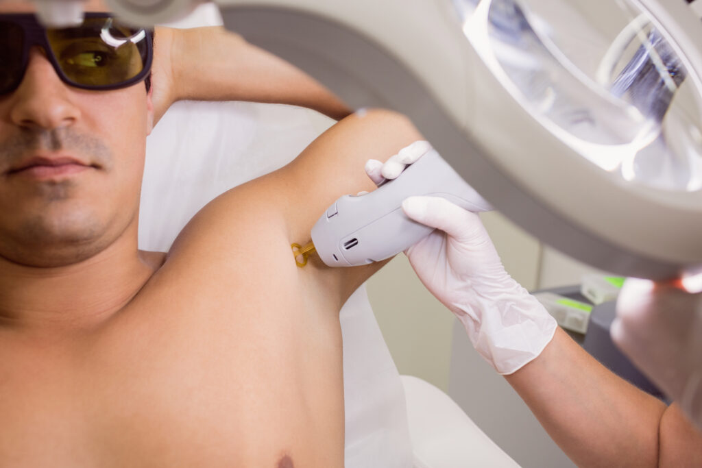 Doctor performing laser hair removal on male patient skin in clinic